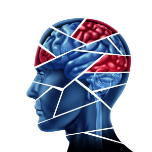 Brain Injury, Attorney, California