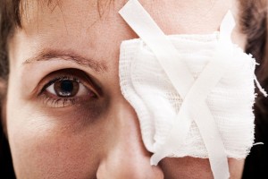 eye injury, lawyer, attorney, California, Los Angeles