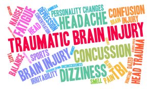 Brain-Injury-Attorney-California